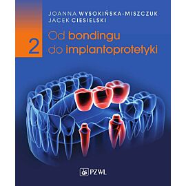 Od bondingu do implantoprotetyki. Cz. II