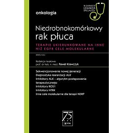 Niedrobnokomórkowy rak płuca. W gabinecie lekarza specjalisty.