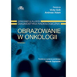 Obrazowanie w onkologii Grainger & Alison Diagnostyka radiologiczna