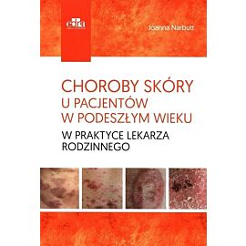 Choroby skóry u pacjentów w podeszłym wieku w praktyce lekarza rodzinnego