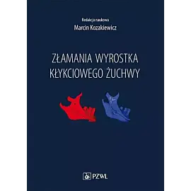 Złamania wyrostka kłykciowego żuchwy