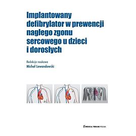 Implantowany defibrylator w prewencji nagłego zgonu sercowego u dzieci i dorosłych