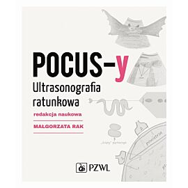 POCUS-y. Ultrasonografia ratunkowa