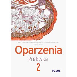 Oparzenia. Praktyka tom 2