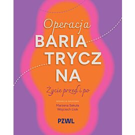 Operacja bariatryczna. Życie przed i po