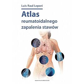 Atlas reumatoidalnego zapalenia stawów / DK Media