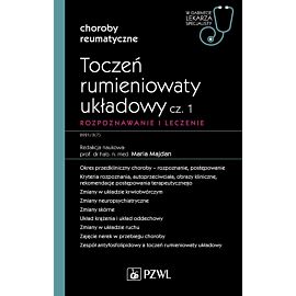 Toczeń rumieniowaty układowy, cz. 1. Rozpoznawanie i leczenie