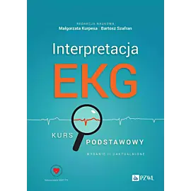 Interpretacja EKG.