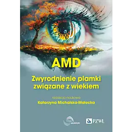AMD Zwyrodnienie plamki żółtej związane z wiekiem